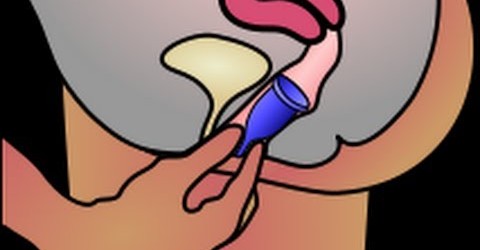 instructions-removal